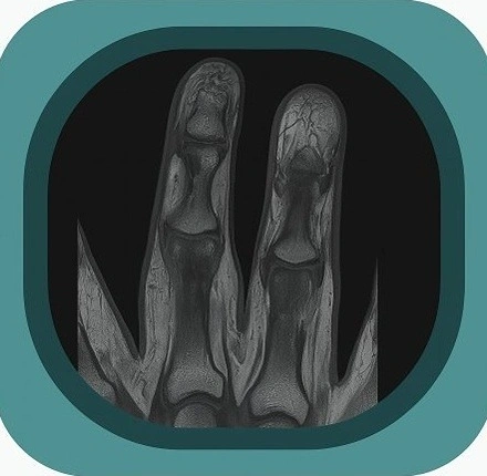 MRI finger anatomy icon
